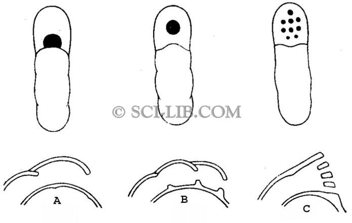 Типы строения устья раковин семейства Ammodiscida